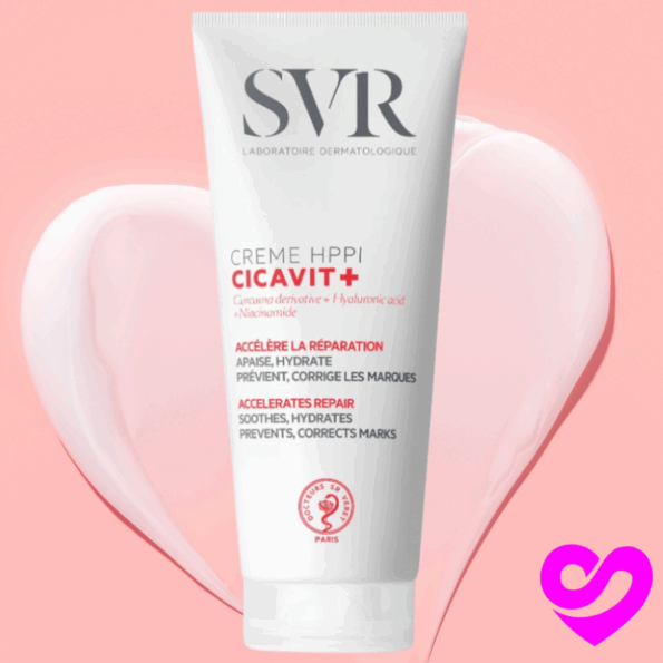svr cicavit hppi